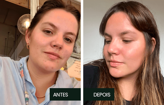 Antes x Depois